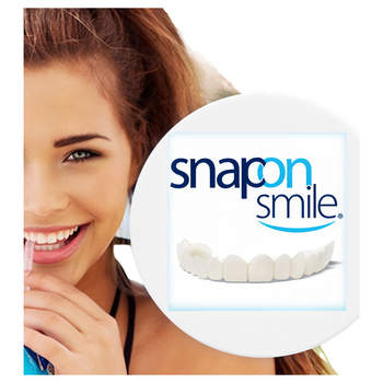 Snap-On Smile